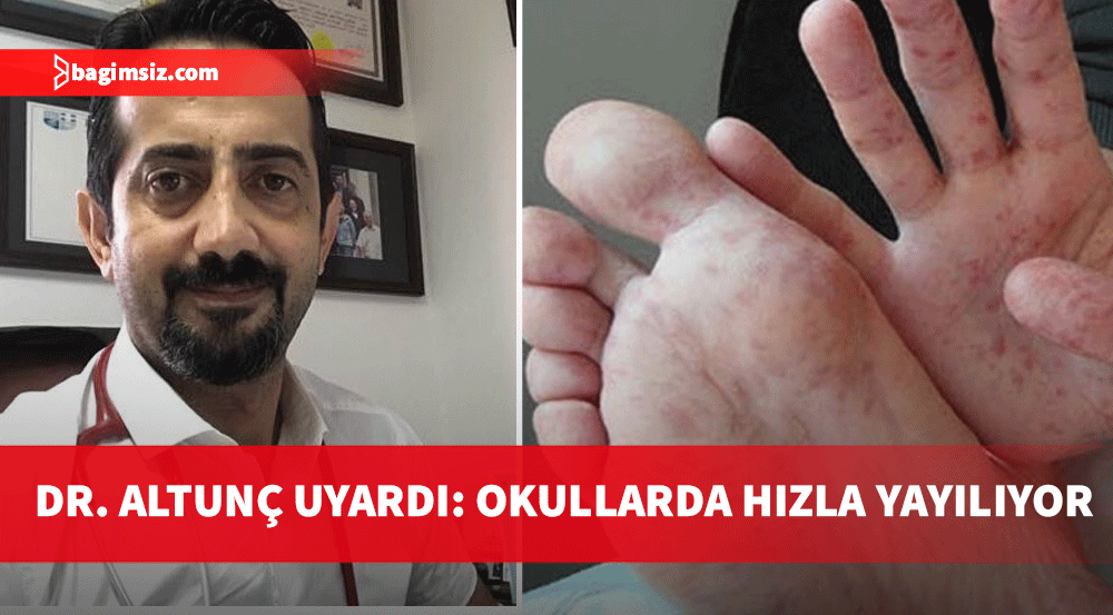 Dr. Umut Altunç: Okullarda el, ayak, ağız hastalığına dikkat!