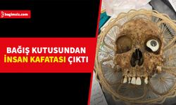 ABD'nin Arizona eyaletinde bağış kutusundan insan kafatası çıktı