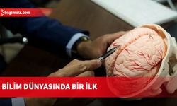 Bilim insanları bedenden bağımsız olan beyni canlı tutmayı başardı