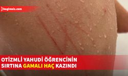 ABD'de otizmli Yahudi öğrencinin sırtına gamalı haç kazındı