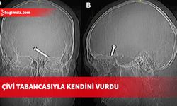 Kendini gözünden vursa da ucuz kurtuldu