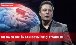 İlk kez insan beynine çip takıldı