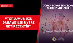 Fatma Tuğlu’dan “Down Sendromu Günü” mesajı…