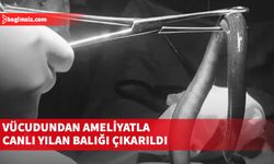 Vücudundan ameliyatla canlı yılan balığı çıkarıldı