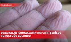 Suda kalan parmakların hep aynı şekilde buruştuğu bulundu