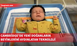 İngiltere'de bilim insanları doğumda beyin hasarını tespit edebilecek başlık geliştirdi