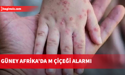 Güney Afrika’da son 5 haftada 13 M çiçeği vakası kaydedildi