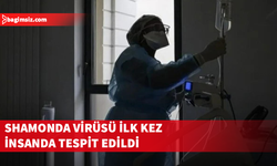 Hayvanlarda görülen Shamonda virüsü ilk kez insanda tespit edildi