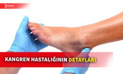 KANGRENİN BELİRTİLERİ VE TEDAVİ YÖNTEMLERİ NELERDİR?