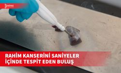 IKNIFE, RAHİM KANSERİNİ SANİYELER İÇİNDE TESPİT EDEBİLİR