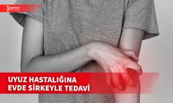 UYUZ HASTALIĞI, EVE TEDAVİSİ VE  DİĞER DETAYLARI