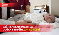 BAĞIRSAKLARI DIŞARIDA DOĞAN BEBEK, 90 GÜNDE 3 AMELİYAT GEÇİRDİ