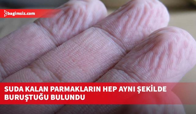 Suda kalan parmakların hep aynı şekilde buruştuğu bulundu